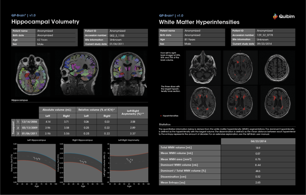 Quibim's Imaging Data Platform