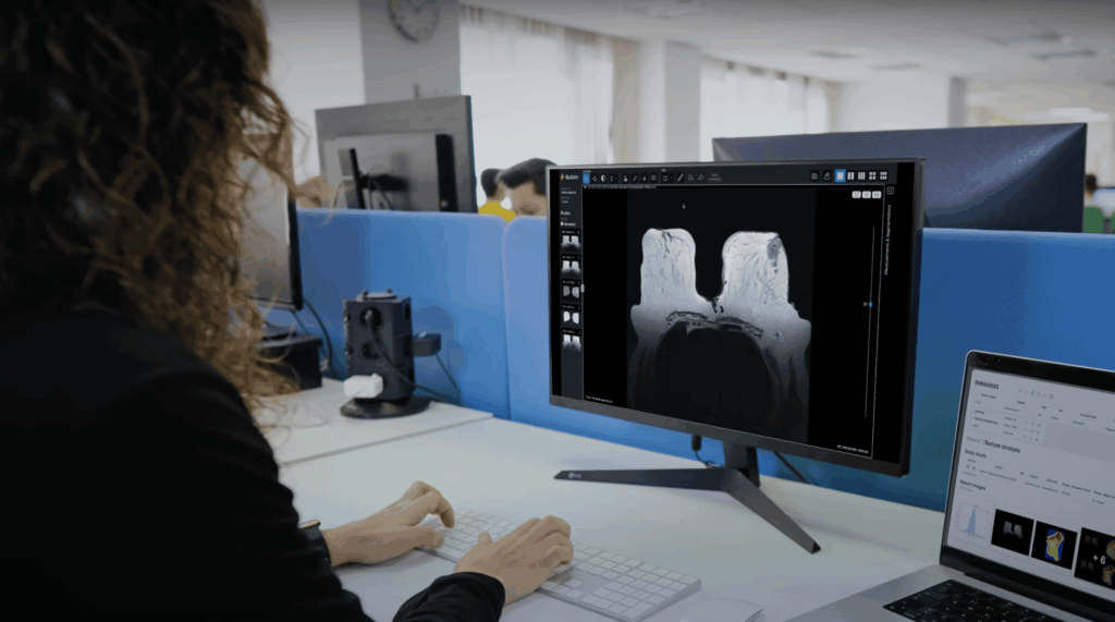 AI in breast cancer screening
